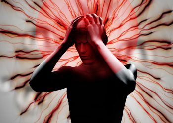 الصداع النصفي