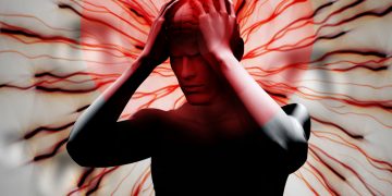 الصداع النصفي