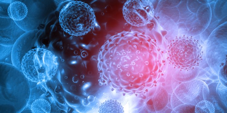 سرطان الثدي