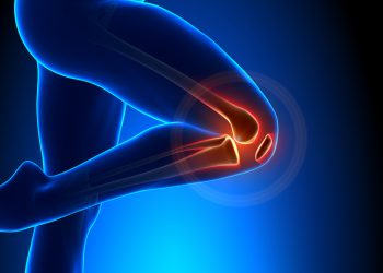 مشاكل في الركبة