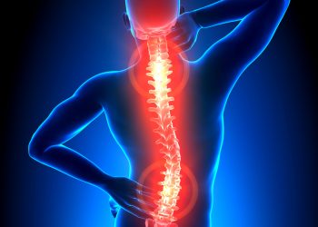 جراحة للظهر