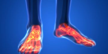 مشاكل في الساق