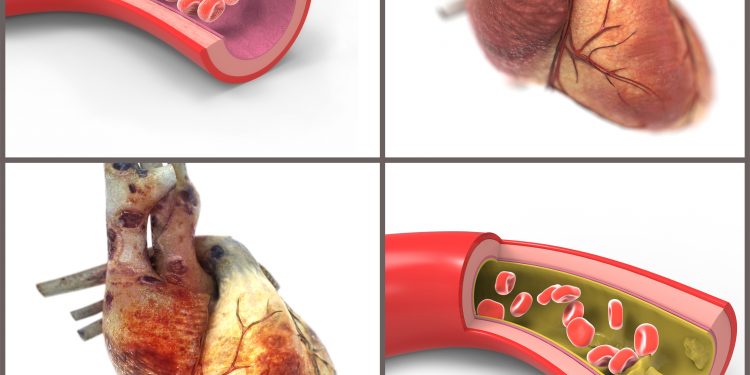 مشاكل في النخر ومشاكل في الاوعية الدموية….طريقة علاج يستحسن التعرف عليه