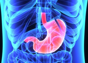 مشاكل الأكل