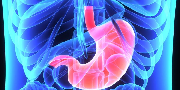 مشاكل الأكل