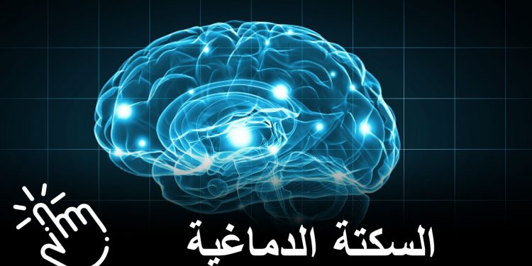 جلطة دماغية