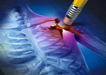 "الحقن لم تساعدني – أورين حل مشكلة الكتف" –  أورن زريف  – Oren Zarif