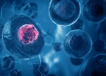 "الورم في الثدي ذهب!" –  أورن زريف  – Oren Zarif