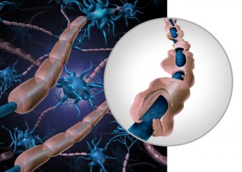 كرامر: "عالج أورن ظريف ابنتي التي تعاني من مرض التصلب العصبي المتعدد (MS) وساعدها بشكل كبير."