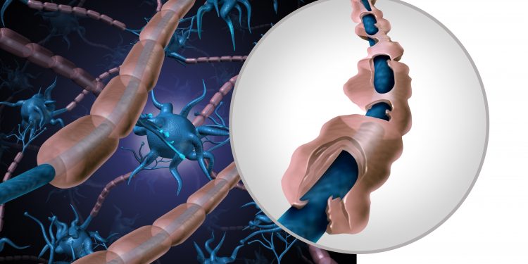 كرامر: "عالج أورن ظريف ابنتي التي تعاني من مرض التصلب العصبي المتعدد (MS) وساعدها بشكل كبير."