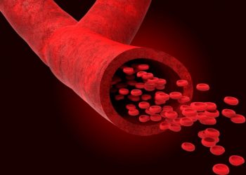 "انسداد عروق الساقين انفتح بفضل أورن ظريف!" –  أورن زريف  – Oren Zarif