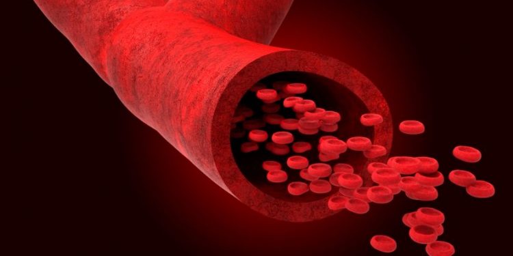 "انسداد عروق الساقين انفتح بفضل أورن ظريف!" –  أورن زريف  – Oren Zarif