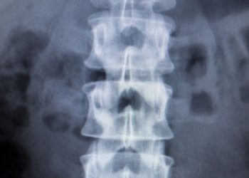 "أورن ظريف أنقذني من انزلاق غضروفي في أسفل ظهري" –  أورن زريف  – Oren Zarif