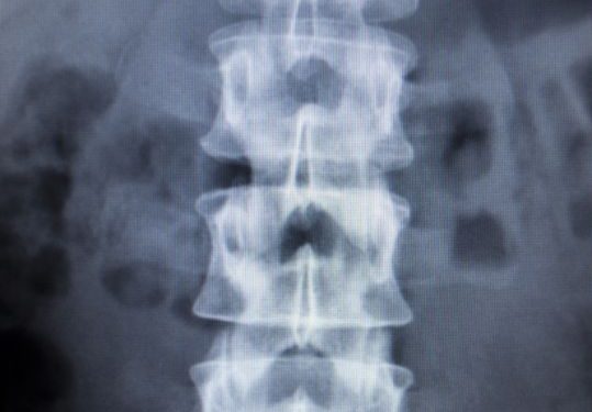 "أورن ظريف أنقذني من انزلاق غضروفي في أسفل ظهري" –  أورن زريف  – Oren Zarif