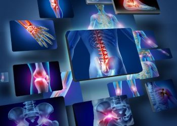 "الألم في جسدي انتقل بفضل أورن ظريف" –  أورن زريف  – Oren Zarif