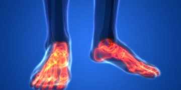 "انسداد عروق الساق انفتح بفضل أورن ظريف!" –  أورن زريف  – Oren Zarif