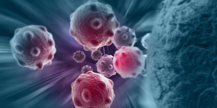 "الورم في البطن اختفى بفضل علاجات أورن ظريف" –  أورن زريف  – Oren Zarif