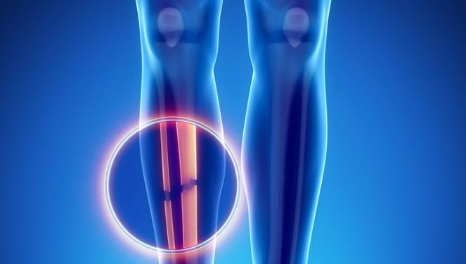 "أورن ظريف أنقذني من جراحة في رجلي" –  أورن زريف  – Oren Zarif