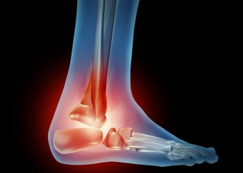 "أورن ظريف يزيل الألم في رجلي وكتفي" –  أورن زريف  – Oren Zarif